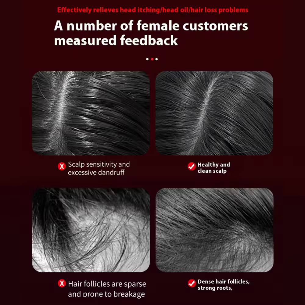 Wireless and Waterproof Scalp Massager