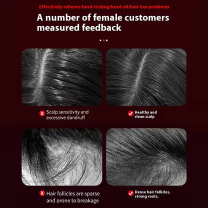 Wireless and Waterproof Scalp Massager
